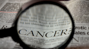 Aproximació a la prevención, diagnóstico, tratamiento y cuidados a la persona con cáncer